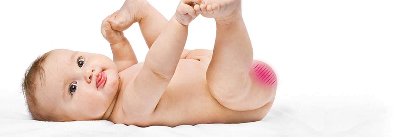 Les problèmes de peau chez les bébés | Rivadouce